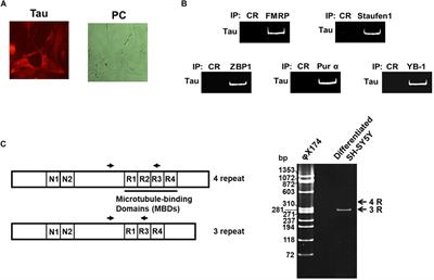 Enhanced Tau Protein Translation by Hyper-Excitation